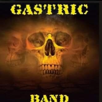 Gastric Band